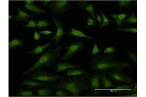 Immunofluorescence of monoclonal antibody to HEXIM1 on HeLa cell.