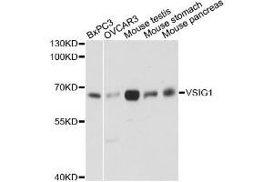 Western blot analysis of extracts of various cell lines, using VSIG1 antibody. (VSIG1 anticorps)