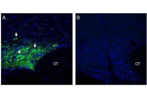 Expression of MAGT1 in rat supra-optic nucleus. (MAGT1 anticorps  (Extracellular, N-Term))