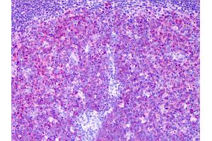 Anti-MARCKSL1 / MRP antibody IHC of human tonsil, germinal center.