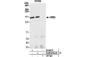 Immunoprecipitation (IP) image for anti-URB2 Ribosome Biogenesis 2 Homolog (URB2) (AA 1474-1524) antibody (ABIN7449667) (URB2 anticorps  (AA 1474-1524))
