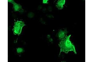 Image no. 3 for anti-Low Density Lipoprotein Receptor Adaptor Protein 1 (LDLRAP1) antibody (ABIN1496689) (LDLRAP1 anticorps)