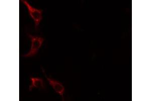 ABIN6267612 staining HeLa cells by IF/ICC.