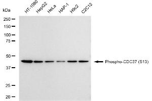 Western blotting analysis using Phospho-CDC37 (S13) antibody (ABIN7798011).