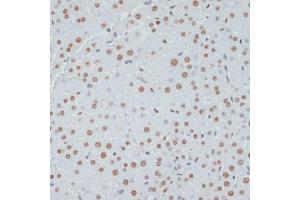 Immunohistochemistry of paraffin-embedded rat liver using Phospho-p53-S33 antibody (ABIN6135330, ABIN6136276, ABIN6136277 and ABIN6225656) at dilution of 1:100 (40x lens). (p53 anticorps  (pSer33))