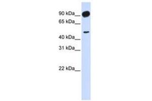 Image no. 1 for anti-Adducin 2 (Beta) (ADD2) (AA 648-697) antibody (ABIN6741133) (ADD2 anticorps  (AA 648-697))