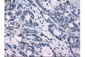 Image no. 8 for anti-Interferon Regulatory Factor 3 (IRF3) antibody (ABIN1498899) (IRF3 anticorps)