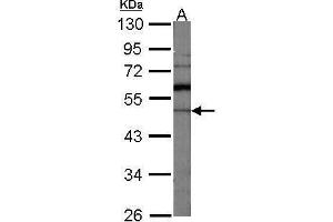 WB Image Sample (30 ug of whole cell lysate) A:NIH-3T3 10% SDS PAGE antibody diluted at 1:1000 (GDI1 anticorps)