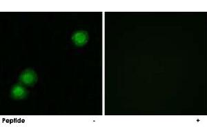 Immunofluorescence analysis of MCF-7 cells, using PKIB polyclonal antibody .