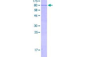 Image no. 1 for Keratin 75 (KRT75) (AA 1-551) protein (GST tag) (ABIN1309028)