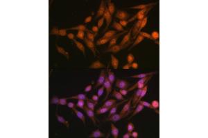 Immunofluorescence analysis of HeLa cells using PSMD13 Polyclonal Antibody (ABIN6132189, ABIN6146337, ABIN6146339 and ABIN6222707) at dilution of 1:100 (40x lens). (PSMD13 anticorps  (AA 1-250))