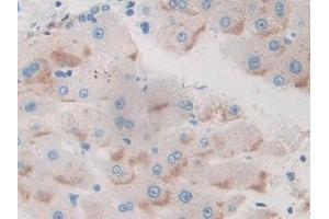 Detection of BCAM in Human Liver Tissue using Polyclonal Antibody to Basal Cell Adhesion Molecule (BCAM)