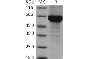 Western Blotting (WB) image for Heat Shock 70kDa Protein 1A (HSPA1A) (Active) protein (His tag) (ABIN7317034)