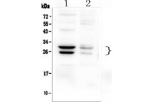 Western blot analysis of COMT using anti-COMT antibody (ABIN6719465).