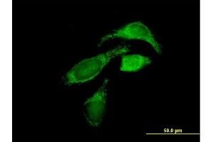 Immunofluorescence of purified MaxPab antibody to OXCT1 on HeLa cell. (OXCT1 anticorps  (AA 1-520))