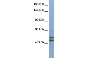 Host:  Rabbit  Target Name:  TEX10  Sample Type:  Fetal Brain lysates  Antibody Dilution:  1. (TEX10 anticorps  (Middle Region))