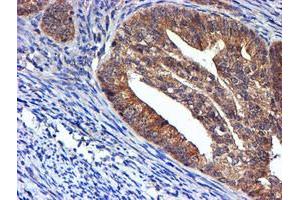 Image no. 11 for anti-NADH Dehydrogenase (Ubiquinone) Complex I, Assembly Factor 7 (NDUFAF7) antibody (ABIN1499667) (NDUFAF7 anticorps)