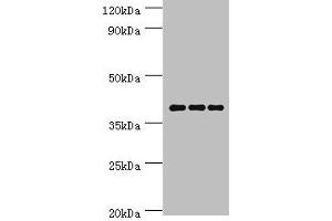 Western blot All lanes: Paired box protein Pax-4 antibody at 6 μg/mL Lane 1: Hela whole cell lysate Lane 2: K562 whole cell lysate Lane 3: Mouse pancreatic Secondary Goat polyclonal to rabbit IgG at 1/10000 dilution Predicted band size: 38, 30 kDa Observed band size: 38 kDa (PAX4 anticorps  (AA 50-200))