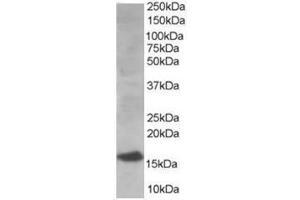 Image no. 1 for anti-Ubiquitin-Conjugating Enzyme E2I (UBE2I) (N-Term) antibody (ABIN374291) (UBE2I anticorps  (N-Term))