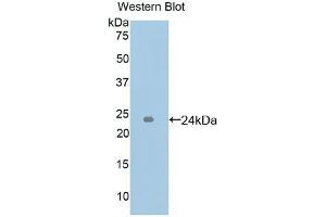 Detection of Recombinant ICAM4, Human using Polyclonal Antibody to Intercellular Adhesion Molecule 4 (ICAM4) (ICAM4 anticorps  (AA 52-234))