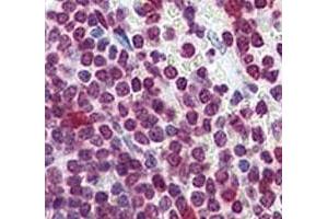 IHC analysis of FFPE human spleen tissue stained with Cdc25A antibody
