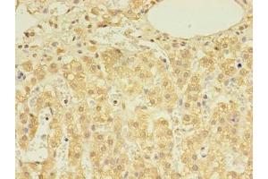 Immunohistochemistry of paraffin-embedded human adrenal gland tissue using ABIN7149631 at dilution of 1:100 (DHRSX anticorps  (AA 32-330))