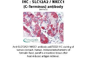 Image no. 2 for anti-Solute Carrier Family 12 (Potassium-Chloride Transporter) Member 2 (SLC12A2) (C-Term) antibody (ABIN1739325)
