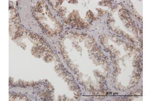 Immunoperoxidase of purified MaxPab antibody to ARG2 on formalin-fixed paraffin-embedded human prostate.