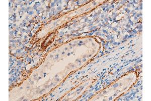 ABIN6267068 at 1/100 staining human seminoma tissue sections by IHC-P. (Smooth Muscle Actin anticorps  (N-Term))