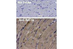 Immunohistochemistry (IHC) image for anti-RAB1B, Member RAS Oncogene Family (RAB1B) (C-Term) antibody (ABIN6254186)