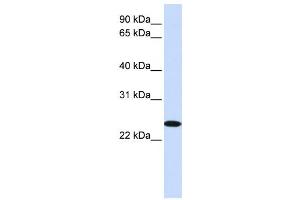Western Blotting (WB) image for anti-Zinc Finger, DHHC-Type Containing 19 (ZDHHC19) antibody (ABIN2458905) (ZDHHC19 anticorps)