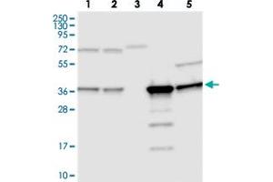 Western blot analysis of Lane 1: RT-4, Lane 2: U-251 MG, Lane 3: Human Plasma, Lane 4: Liver, Lane 5: Tonsil with C11orf54 polyclonal antibody . (C11orf54 anticorps)