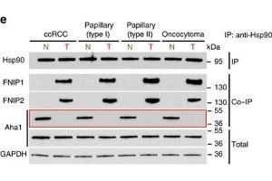 High levels of FNIPs make renal tumours sensitive to Hsp90 inhibitor GB.