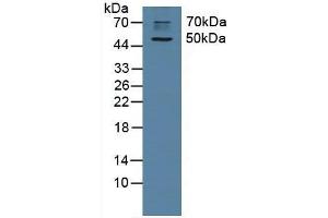 Detection of CHRM1 in Rat Brain Tissue using Polyclonal Antibody to Cholinergic Receptor, Muscarinic 1 (CHRM1) (CHRM1 anticorps  (AA 210-363))