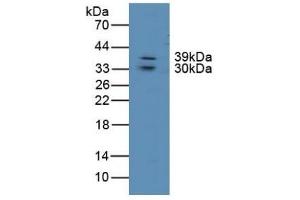 Detection of LIPG in Human Lung Tissue using Polyclonal Antibody to Lipase, Endothelial (LIPG)