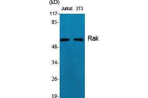 Western Blotting (WB) image for anti-Fyn-Related Kinase (FRK) (Internal Region) antibody (ABIN3186683) (FRK anticorps  (Internal Region))
