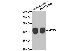 Western blot analysis of extracts of mouse kidney and rat kidney cell lines, using GATM antibody. (GATM anticorps)