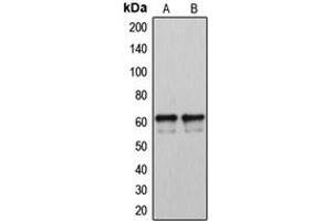 Western blot analysis of Cytochrome P450 2U1 expression in LOVO (A), A2058 (B) whole cell lysates. (CYP2U1 anticorps  (Center))