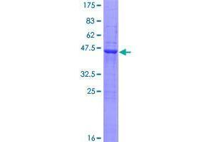 Image no. 1 for erythrocyte Membrane Protein Band 4.1 Like 4A (EPB41L4A) (AA 1-185) protein (GST tag) (ABIN1352888)