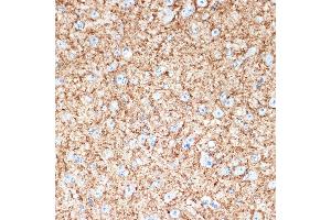 Immunohistochemistry of paraffin-embedded mouse brain using V Rabbit mAb (ABIN7271312) at dilution of 1:100 (40x lens). (VAMP1 anticorps)