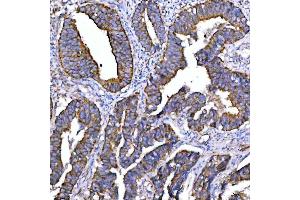 IHC analysis of Syntaxin 18/STX18 using anti-Syntaxin 18/STX18 antibody (ABIN7599259). (Syntaxin 18 anticorps  (AA 1-313))