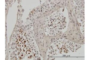 Image no. 1 for anti-Transition Protein 1 (During Histone To Protamine Replacement) (TNP1) (AA 1-56) antibody (ABIN598980) (TNP1 anticorps  (AA 1-56))