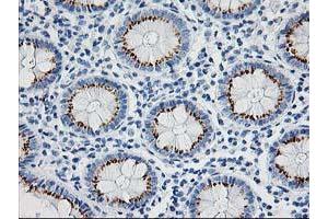 Immunohistochemical staining of paraffin-embedded Human colon tissue using anti-NDEL1 mouse monoclonal antibody. (NDEL1 anticorps)