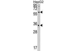Western Blotting (WB) image for anti-CDP-Diacylglycerol Synthase (Phosphatidate Cytidylyltransferase) 2 (CDS2) antibody (ABIN5018827) (CDS2 anticorps)