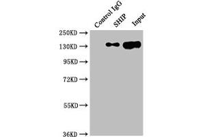 Immunoprecipitating SHIP in Raji whole cell lysate Lane 1: Rabbit control IgG instead of ABIN7127806 in Raji whole cell lysate.