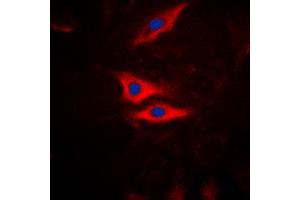 Immunofluorescent analysis of PLA2G4A (pS505) staining in HeLa cells. (PLA2G4A anticorps  (pSer505))