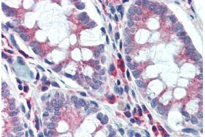 Human Colon (formalin-fixed, paraffin-embedded) stained with NPC1 antibody ABIN462125 followed by biotinylated anti-mouse IgG secondary antibody ABIN481714, alkaline phosphatase-streptavidin and chromogen.