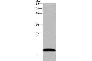 Western Blot analysis of 293T cell using NDUFA8 Polyclonal Antibody at dilution of 1:300 (NDUFA8 anticorps)