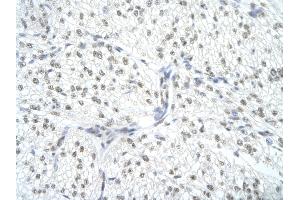 Rabbit Anti-SNRPA Antibody       Paraffin Embedded Tissue:  Human cardiac cell   Cellular Data:  Epithelial cells of renal tubule  Antibody Concentration:   4. (SNRPA1 anticorps  (Middle Region))