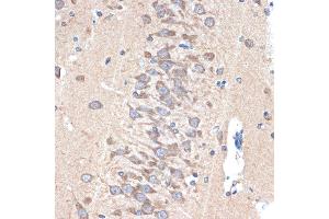 Immunohistochemistry of paraffin-embedded rat brain using P Rabbit mAb (ABIN7269161) at dilution of 1:100 (40x lens).